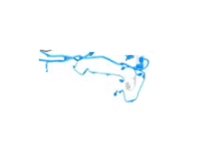 BMW 61-12-8-780-846 Cable Set, Front End